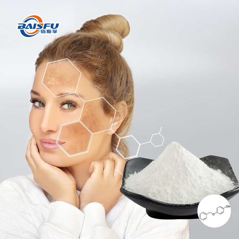 Monobenzone as a Skin Depigmenting Agent for the Treatment of Hyperpigmentation